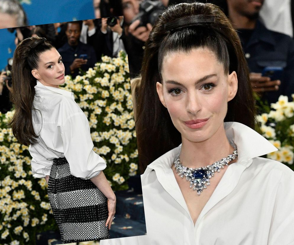 O rejuvenescimento facial de Anne Hathaway sugere técnicas modernas como lifting endoscópico e resurfacing, com naturalidade e elegância.